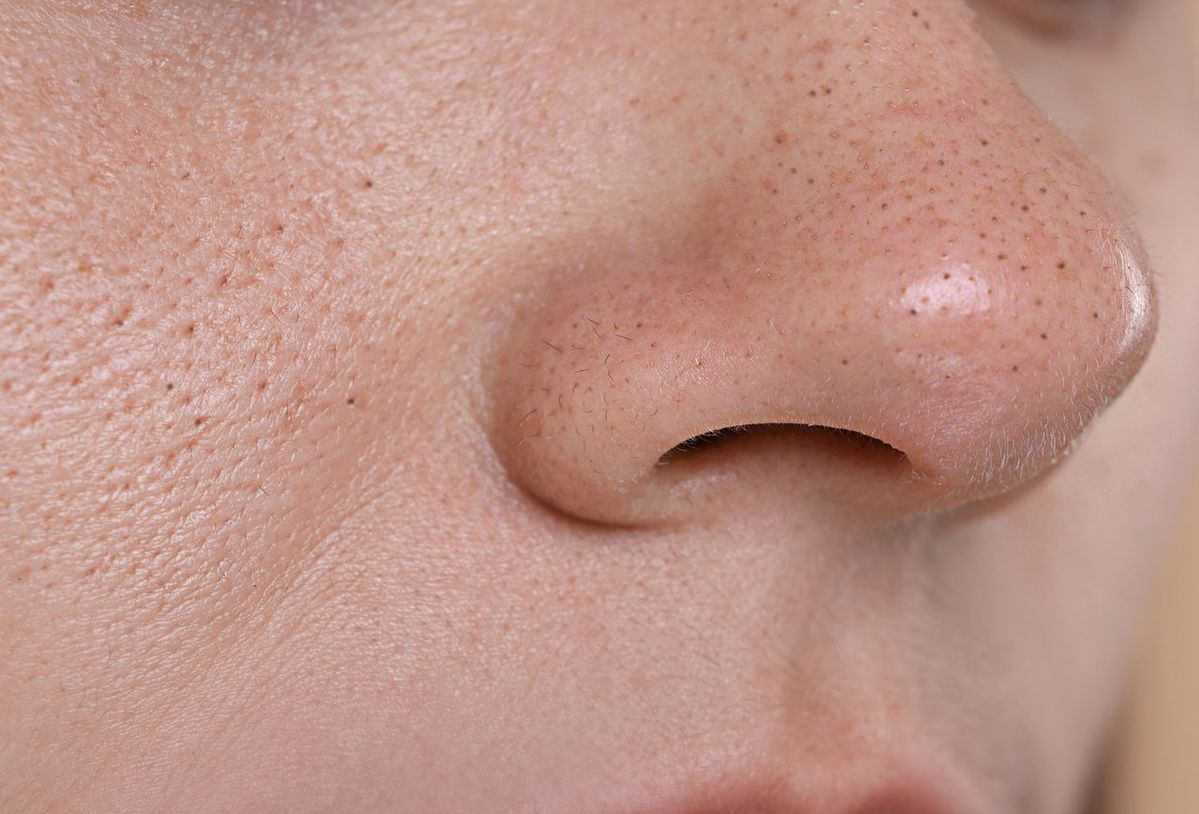 Solusi Ampuh Mengecilkan Pori-Pori di Hidung dan Pipi : Rahasia Es Batu, Clay Mask, dan Serum Wajib Kamu Coba!