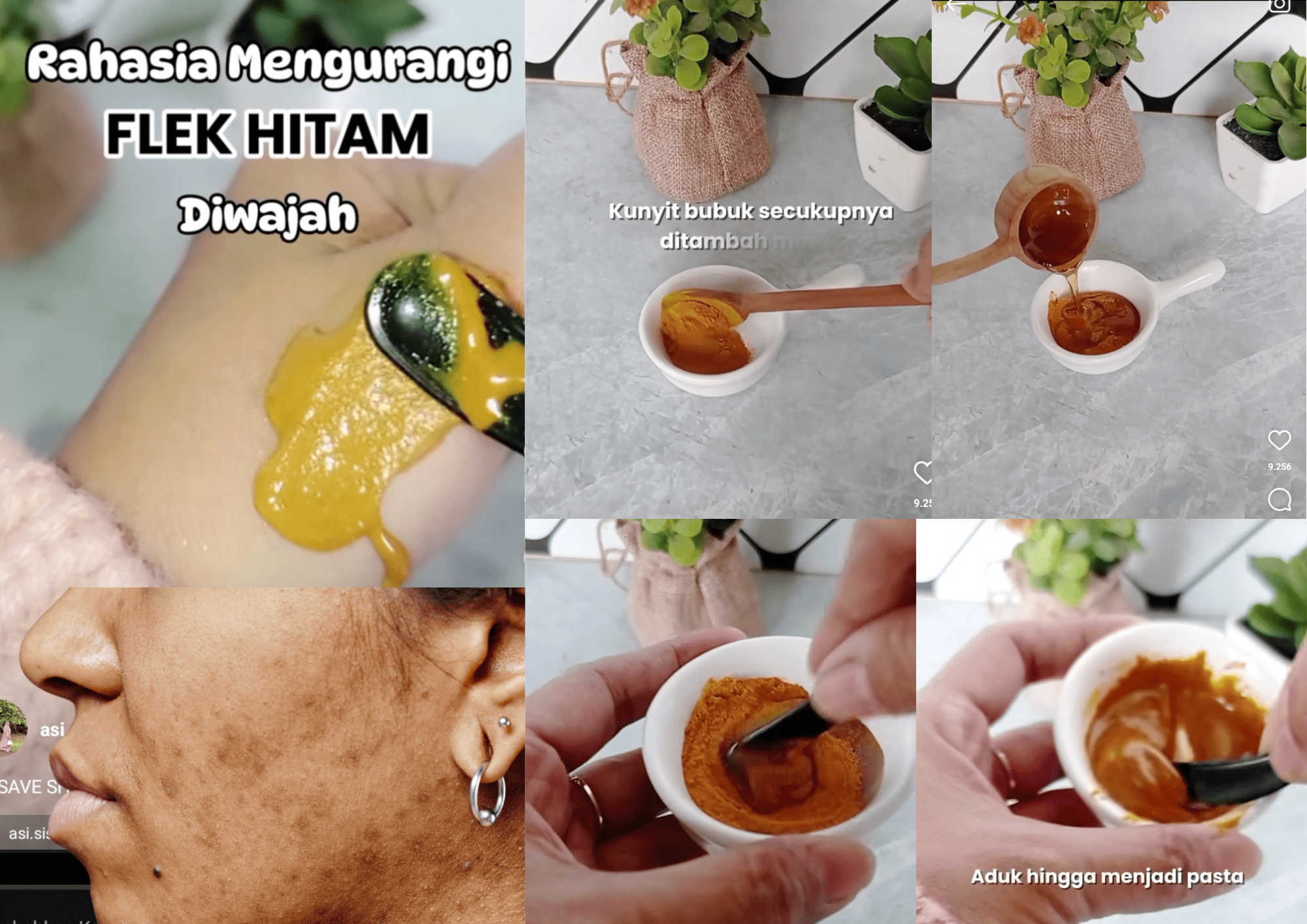 Rahasia Mengurangi Flek Hitam di Wajah Hanya dengan 2 bahan ini! Yuk Bikin Wajah Kembali Awet Muda Lagi