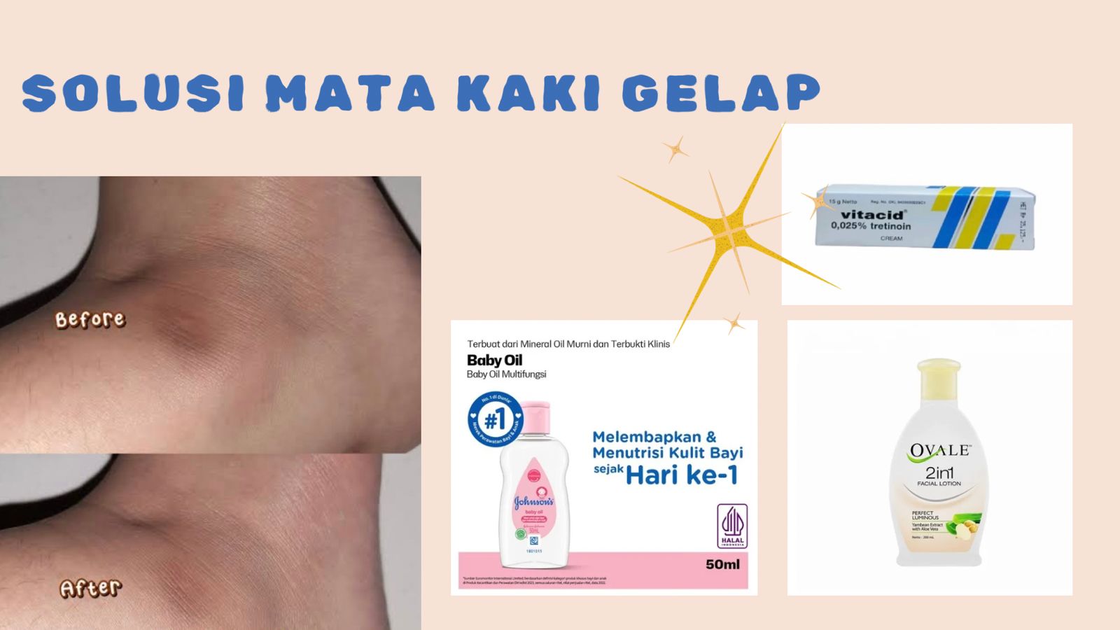 Mata Kaki Gelap dan Kering? 4 Produk Alfamart ini Bisa Jadi solusi, Harga Dibawah 50 Ribu Rupiah