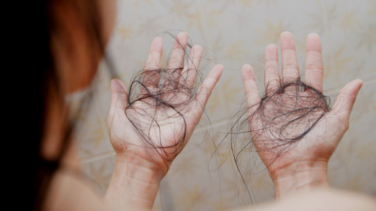 Jangan Sepelekan Rambut Rontok, Salah Perawatan Bisa Bikin Kepala Botak Loh...