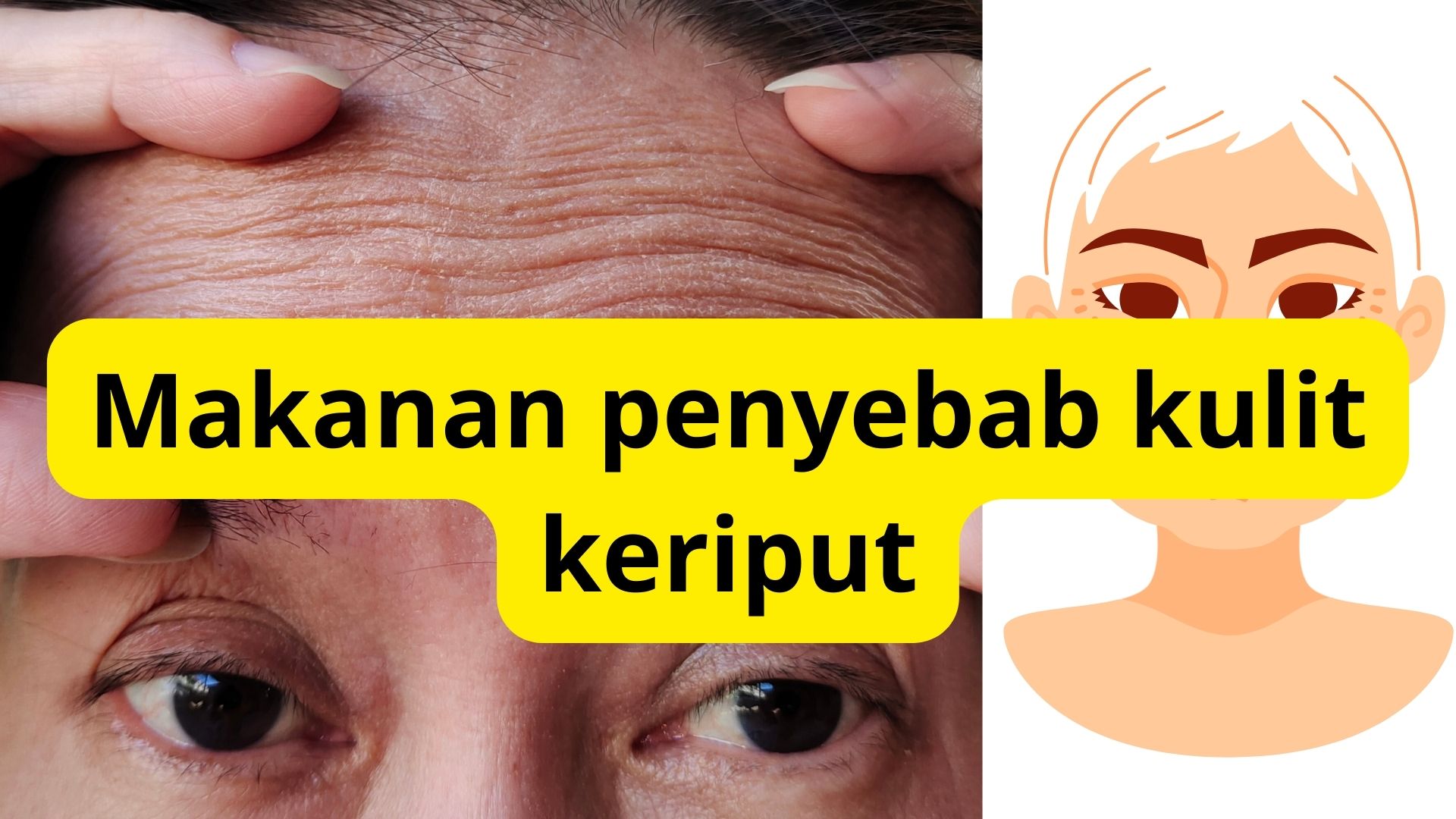 Deretan Makanan Yang Bikin Kulit Cepat Keriput, Stop Dari Sekarang Sebelum Menyesal, Simak Selengkapnya