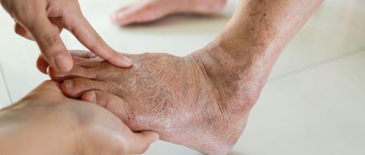 Stop! Gula: Kenikmatan di Lidah yang Harus Dibayar Mahal oleh Darah