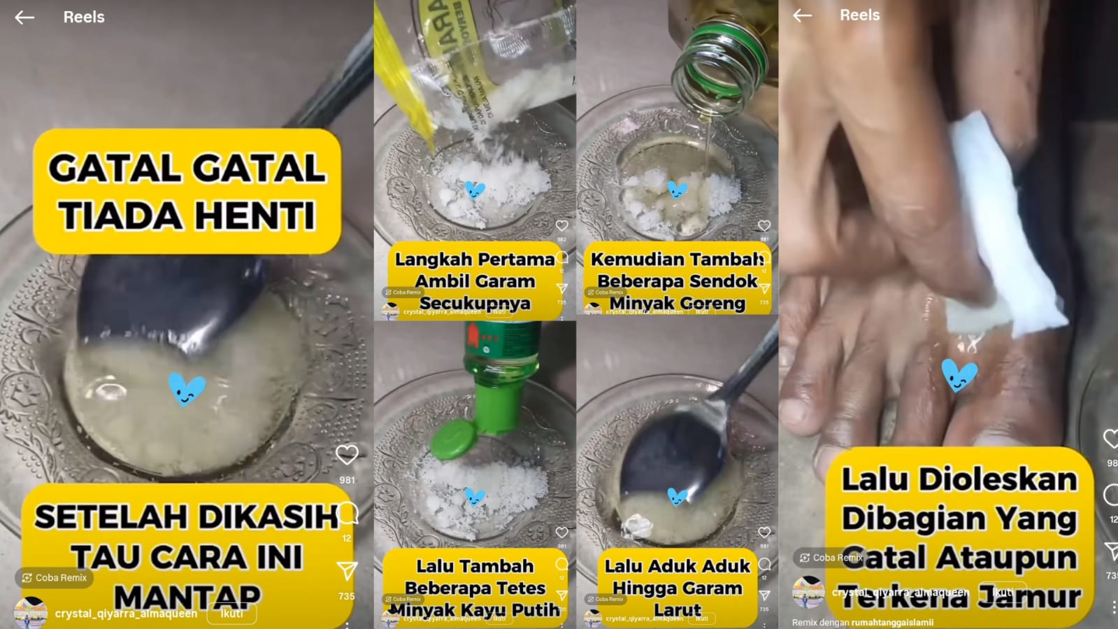 Atasi Kaki Gatal-gatal dengan Minyak Kayu Putih dan Campuran Bahan Ini, Hasilnya Gatal-gatal Langsung Sirna