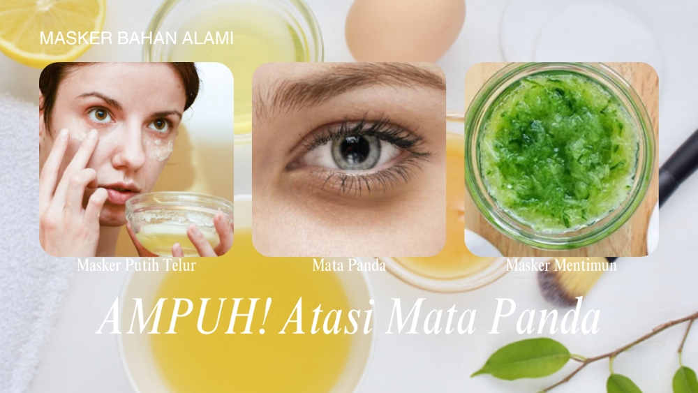 Tips Ampuh dengan Bahan Alami,  Atasi Kantung Mata Hitam Secara Cepat, Kamu Harus Coba!