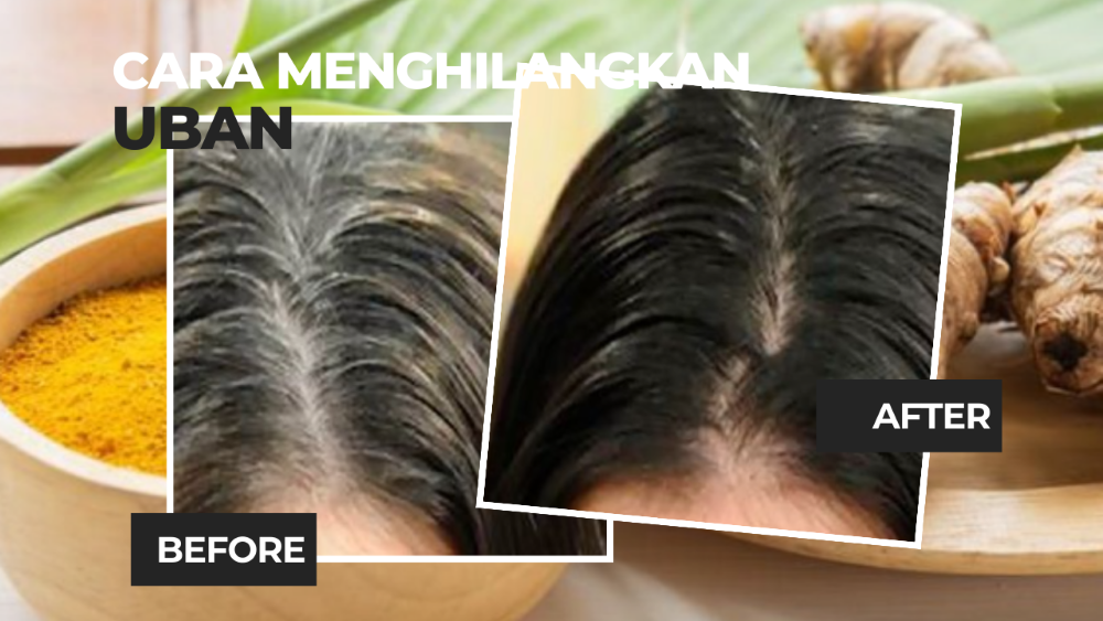 Cara Menghilangkan Uban Bikin Rambut Hitam Alami dan Indah Berkilau 