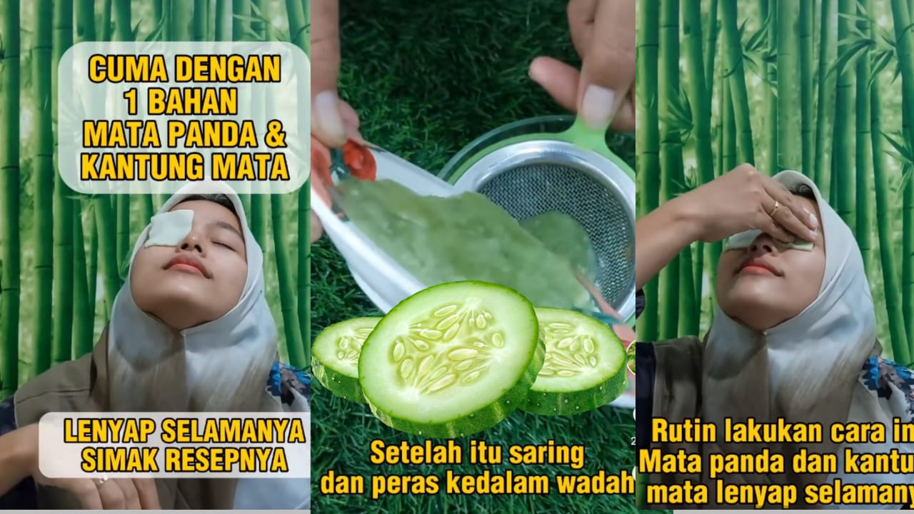 Cara Menghilangkan Kantung Mata Tebal dan Hitam, Cukup Oleskan Bahan Dapur Ini, Dioles Malam Besoknya Hilang