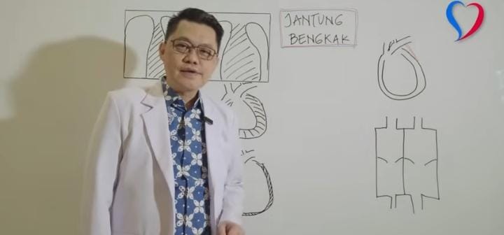 Panduan Lengkap Memahami Jantung Bengkak: Penyebab, Gejala, dan Cara Mengatasinya