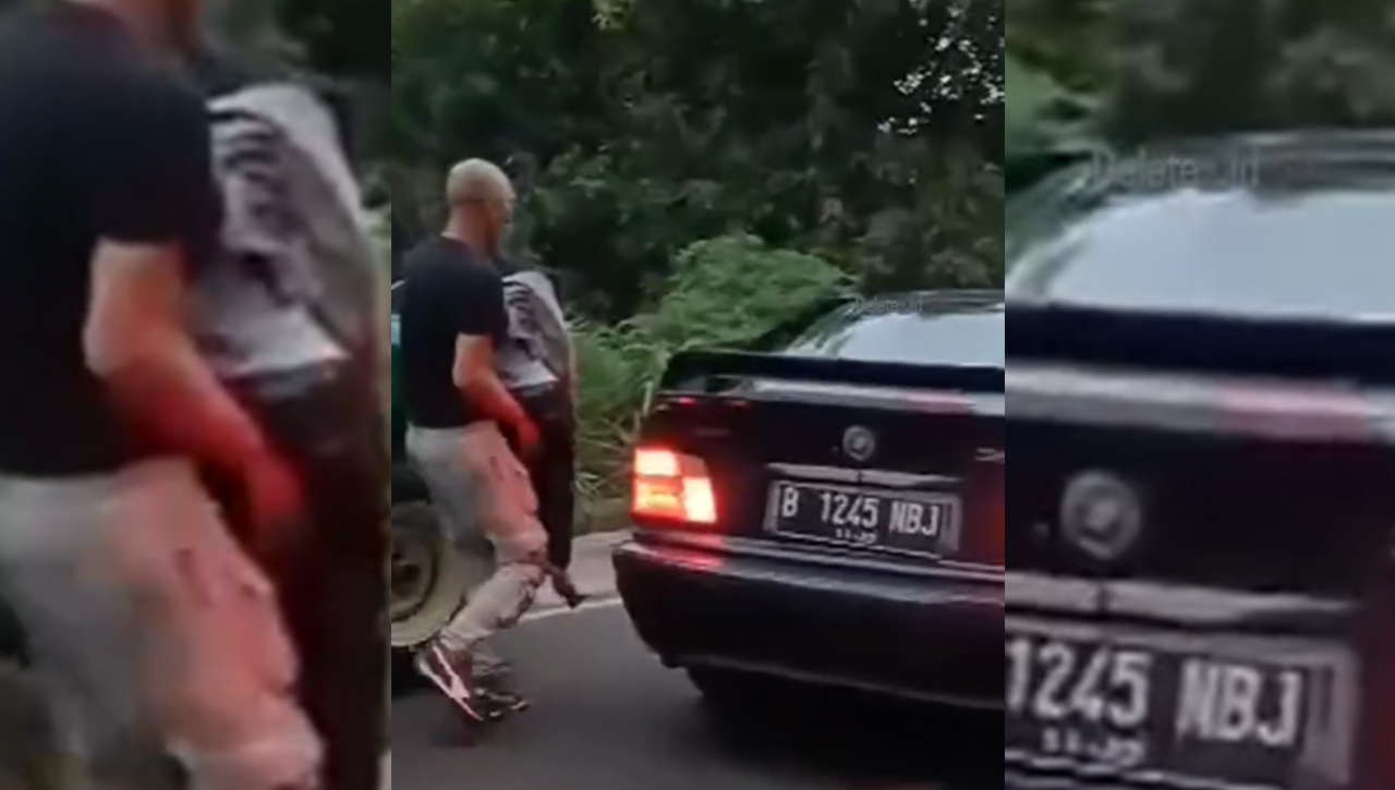 Kondisi Bocah Tertabrak Mobil Basis Dewa 19 Membaik, Keluarga Pilih Penyelesaian Hukum Secara Kekeluargaan