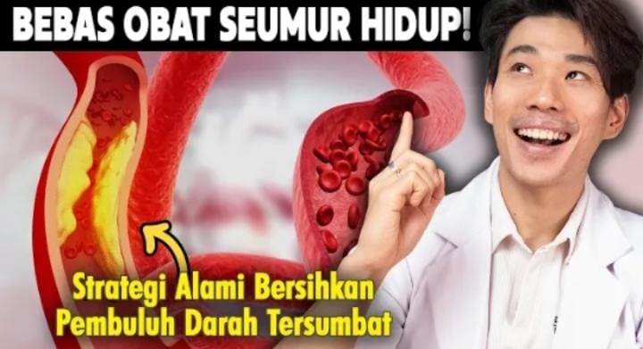 Cara Alami Bersihkan Sumbatan Pembuluh Darah: Ternyata Bukan Cuma Soal Diet!