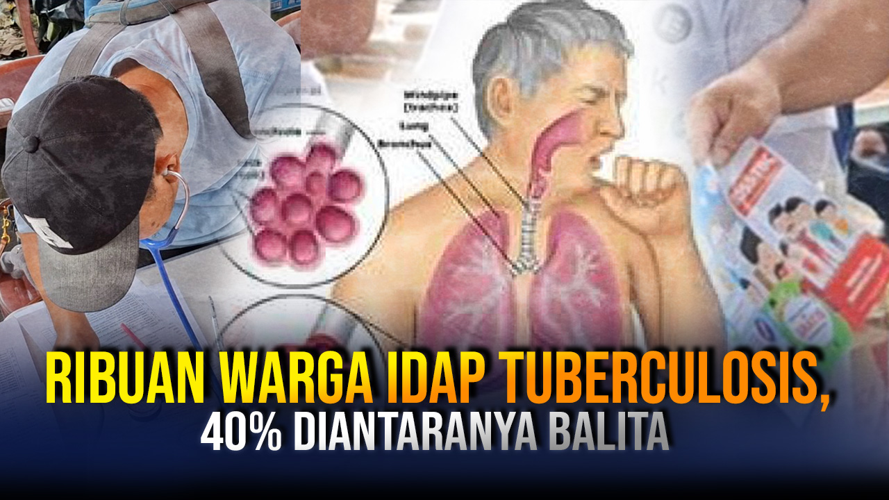 Ribuan Warga Kota Tasik Idap TB, Empat Puluh Persen di Antaranya Balita,  Penularan dari Anggota Keluarga