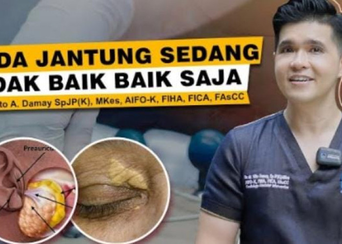 12 Sinyal Tubuh Saat Jantung Bermasalah: Sudahkah Anda Memeriksanya?
