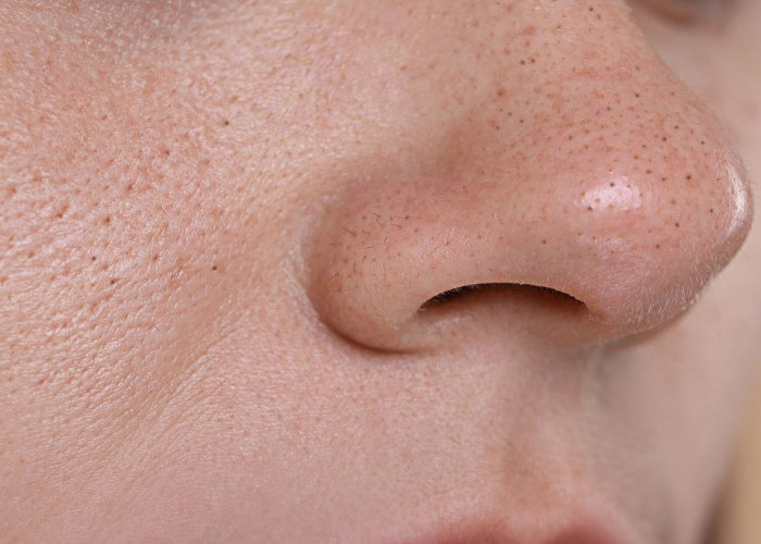 Solusi Ampuh Mengecilkan Pori-Pori di Hidung dan Pipi : Rahasia Es Batu, Clay Mask, dan Serum Wajib Kamu Coba!