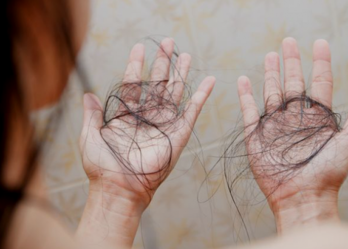 Jangan Sepelekan Rambut Rontok, Salah Perawatan Bisa Bikin Kepala Botak Loh...