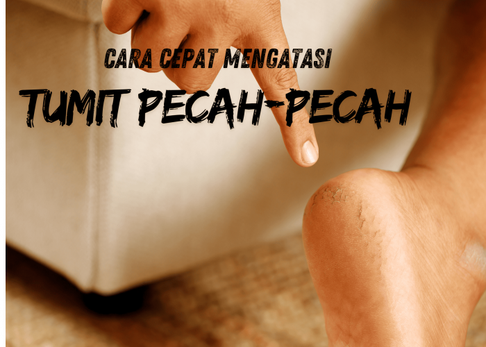 Cara Mudah Mengatasi Tumit Pecah-Pecah, Hanya dengan 2 Bahan