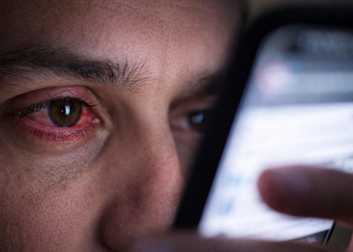 Sering Scroll HP Berjam-jam? Mata Bisa Lelah hingga Buram, Ini Cara Sederhana untuk Menguranginya