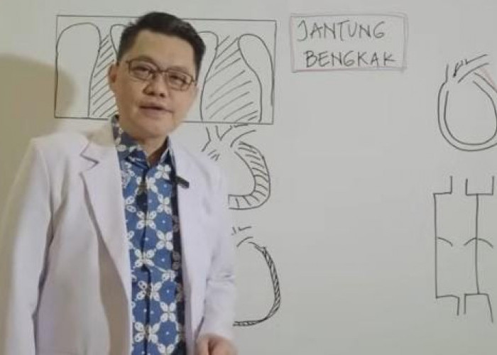 Panduan Lengkap Memahami Jantung Bengkak: Penyebab, Gejala, dan Cara Mengatasinya