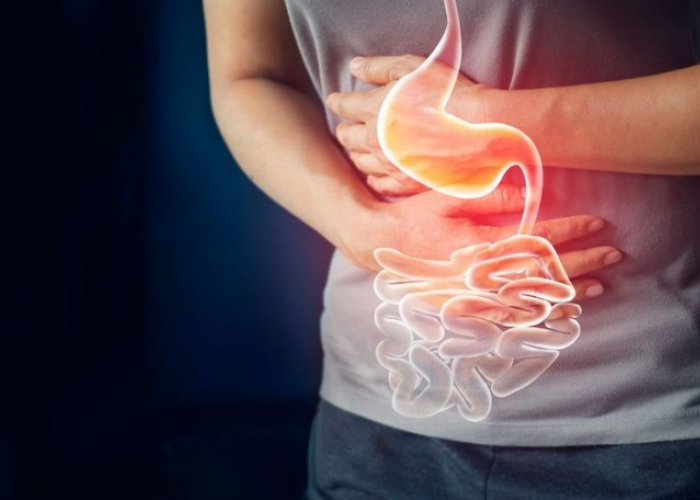 Asam Lambung Kambuh Saat Puasa? Tenang, Ini Tips Aman dari Dokter Biar Ibadah Tetap Lancar