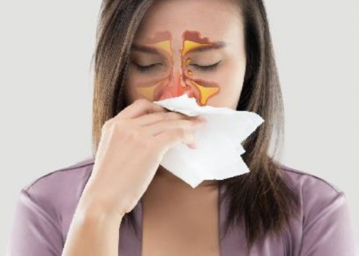 Sama-Sama Bikin Hidung Mampet, Ini Tanda Pasti Kalau Flu Anda Sudah Berubah Jadi Sinus