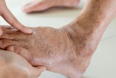 Stop! Gula: Kenikmatan di Lidah yang Harus Dibayar Mahal oleh Darah