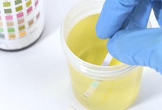 Warna Urin Pekat Saat Puasa Bikin Panik? Ini Penjelasan Medis Lengkap dari Dokter Saddam Ismail