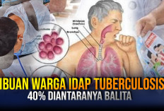 Ribuan Warga Kota Tasik Idap TB, Empat Puluh Persen di Antaranya Balita,  Penularan dari Anggota Keluarga