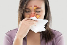 Sama-Sama Bikin Hidung Mampet, Ini Tanda Pasti Kalau Flu Anda Sudah Berubah Jadi Sinus